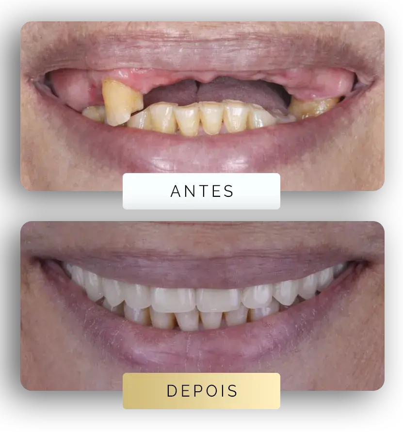 Pagina-Antes-e-depois-1