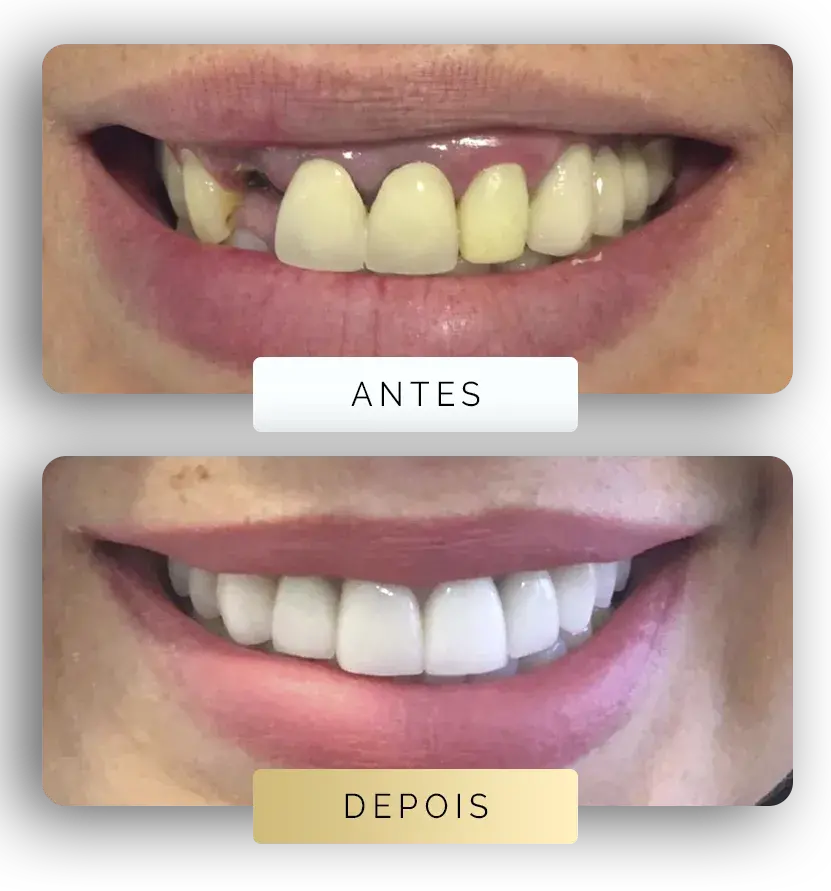 Pagina-Antes-e-depois-2