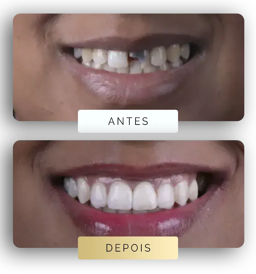 Pagina-Antes-e-depois-3